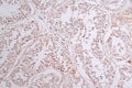 SOCS7 Recombinant Monoclonal Antibody – Figure 1 of 2