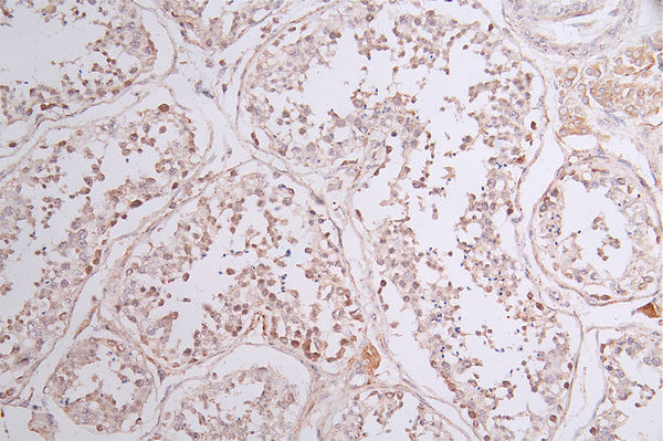 SOCS7 Recombinant Monoclonal Antibody – Figure 1 of 2