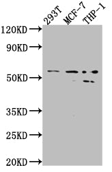 Western Blot
Positive WB detected in: 293T whole cell lysate, MCF-7 whole cell lysate, THP-1 whole cell lysate
All lanes: MMP12 antibody at 1:1000
Secondary
Goat polyclonal to rabbit IgG at 1/50000 dilution
Predicted band size: 55 kDa
Observed band size: 54, 45 kDa