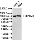 Western Blot
Positive WB detected in:MCF-7 whole cell lysate(30µg) , Hela whole cell lysate(30µg) 
All lanes: CLPTM1 antibody at 1:1000
Secondary
Goat polyclonal to rabbit IgG at 1/40000 dilution<br /
Predicted band size: 76 kDa 
Observed band size: 100 kDa
Exposure time：2min