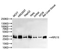 Western Blot
Positive WB detected in: MCF-7 whole cell lysate(30µg), HEK293T whole cell lysate(30µg), HepG2 whole cell lysate(30µg), Hela whole cell lysate(30µg), Jurkat whole cell lysate(30µg), HT-29 whole cell lysate(30µg), Rat liver tissue lysate(30µg)
All lanes:RPL13 antibody at 1:1000
Secondary
Goat polyclonal to rabbit IgG at 1/40000 dilution
Predicted band size: 24 kDa
Observed band size: 28 kDa
Exposure time：30s