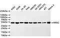 Western Blot
Positive WB detected in: K562 whole cell lysate(20µg) ,A549 whole cell lysate(20µg) , HL-60 whole cell lysate(20µg) , HEK293 whole cell lysate(20µg) ,SH-SY5Y whole cell lysate(20µg) ,NIH/3T3 whole cell lysate(20µg) ,4T1 whole cell lysate(20µg) ,Ntera-2 whole cell lysate(20µg) ,Mouse brain tissue lysate(20µg) 
All lanes: MEK2 antibody at 1:1000
Secondary
Goat polyclonal to rabbit IgG at 1/40000 dilution
Predicted band size: 44 kDa
Observed band size: 44 kDa
Exposure time：20s