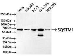 Western Blot
Positive WB detected in: HeLa whole cell lysate(30µg) , HepG2 whole cell lysate(30µg) , PC-3 whole cell lysate(30µg) , COLO205 whole cell lysate(30µg) , HEK293 whole cell lysate(30µg) 
All lanes: SQSTM1 antibody at 1:1000
Secondary
Goat polyclonal to rabbit IgG at 1/50000 dilution
Predicted band size: 48 kDa
Observed band size: 62 kDa
Exposure time: 2min