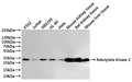 Western Blot
Positive WB detected in: K562 whole cell lysate(30µg), Jurkat whole cell lysate(30µg), HEK293 whole cell lysate(30µg), HL-60 whole cell lysate(30µg), Hela whole cell lysate(30µg), Mouse kidney tissue lysate(30µg), Rat kidney tissue lysate(30µg), Mouse liver tissue lysate(30µg)
All lanes: Adenylate kinase 2 antibody at 1:1000
Secondary
Goat polyclonal to rabbit IgG at 1/40000 dilution
Predicted band size: 26 kDa
Observed band size: 26 kDa
Exposure time：10s