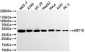 Western Blot
Positive WB detected in: MCF-7 whole cell lysate(30µg) , A549 whole cell lysate(30µg) , HT-29 whole cell lysate(30µg) , HepG2 whole cell lysate(30µg) , Hela whole cell lysate(30µg) , PC-3 whole cell lysate(30µg) 
All lanes: Cytokeratin 19 antibody at 1:1000
Secondary
Goat polyclonal to rabbit IgG at 1/40000 dilution
Predicted band size: 44 kDa
Observed band size: 49 kDa
Exposure time：10s