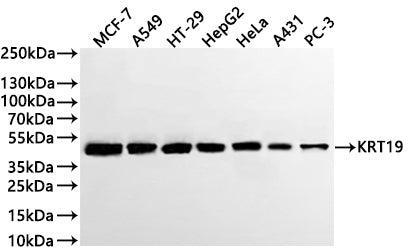Western Blot
Positive WB detected in: MCF-7 whole cell lysate(30µg) , A549 whole cell lysate(30µg) , HT-29 whole cell lysate(30µg) , HepG2 whole cell lysate(30µg) , Hela whole cell lysate(30µg) , PC-3 whole cell lysate(30µg) 
All lanes: Cytokeratin 19 antibody at 1:1000
Secondary
Goat polyclonal to rabbit IgG at 1/40000 dilution
Predicted band size: 44 kDa
Observed band size: 49 kDa
Exposure time：10s