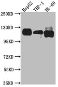 Western Blot
Positive WB detected in: HepG2 whole cell lysate, THP-1 whole cell lysate, HL-60 whole cell lysate
All lanes: Notch1 antibody at 1:1000
Secondary
Goat polyclonal to rabbit IgG at 1/50000 dilution
Predicted band size: 273 kDa
Observed band size: 120 kDa