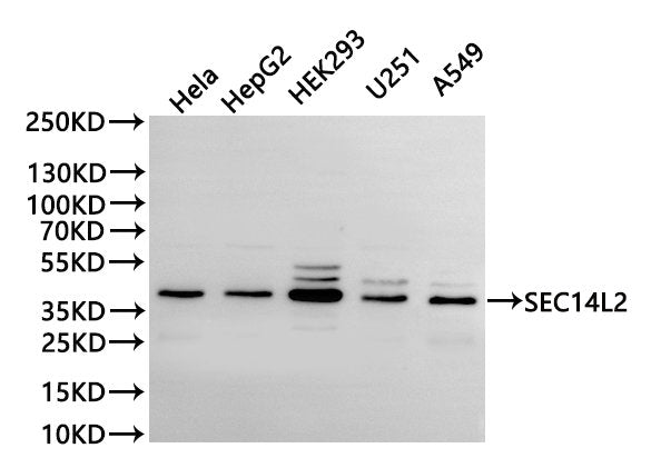 Western Blot
Positive WB detected in: Hela whole cell lysate(30µg), HepG2 whole cell lysate(30µg), HEK293 whole cell lysate(30µg), U-251MG whole cell lysate(30µg), A549 whole cell lysate(30µg)
All lanes: SEC14L2 antibody at 1:1000
Secondary
Goat polyclonal to rabbit IgG at 1/40000 dilution
Predicted band size: 46 kDa
Observed band size: 40 kDa
Exposure time：1min