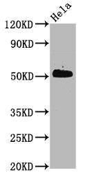 Western Blot
Positive WB detected in Hela whole cell lysate
All lanes Phospho-CDC37 antibody at 0.6μg/ml
Secondary
Goat polyclonal to rabbit IgG at 1/50000 dilution
Predicted band size: 50 KDa
Observed band size: 50 KDa
