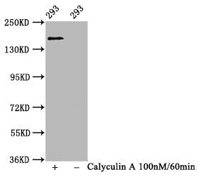 Western Blot
Positive WB detected in 293 whole cell lysate(treated with Calyculin A or not) 
All lanes Phospho-SMC1A antibody at 1.11μg/ml
Secondary
Goat polyclonal to rabbit IgG at 1/50000 dilution
Predicted band size: 160 KDa
Observed band size: 160 KDa