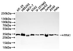 Western Blot
Positive WB detected in: HT-29 whole cell lysate(20µg) , HEK293 whole cell lysate(20µg) , MCF-7 whole cell lysate(20µg) , K562 whole cell lysate(20µg) , U-251MG whole cell lysate(20µg) , HepG2 whole cell lysate(20µg) , Jurkat whole cell lysate(20µg) , A549 whole cell lysate(20µg) , HeLa whole cell lysate(20µg) 
All lanes: PPA1 antibody at 1:1000
Secondary
Goat polyclonal to rabbit IgG at 1/40000 dilution
Predicted band size: 33 kDa
Observed band size: 33 kDa
Exposure time：5s
