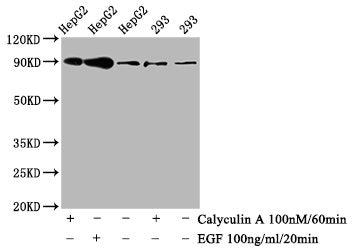Western Blot
Positive WB detected in HepG2 whole cell lysate,293 whole cell lysate(treated with Calyculin A or EGF) 
All lanes Phospho-NFE2L2 antibody at 0.8μg/ml
Secondary
Goat polyclonal to rabbit IgG at 1/50000 dilution
Predicted band size: 90 KDa
Observed band size: 90 KDa