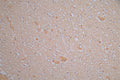 IHC image of CSB-RA614975MA1HU diluted at 1:150 and staining in paraffin-embedded human brain tissue performed on a Leica BondTM system. After dewaxing and hydration, antigen retrieval was mediated by high pressure in a citrate buffer (pH 6.0) . Section was blocked with 10% normal goat serum 30min at RT. Then primary antibody (1% BSA) was incubated at 4°C overnight. The primary is detected by a Goat anti-Rabbit IgG labeled by HRP and visualized using 0.05% DAB.