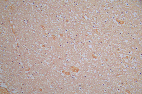 IHC image of CSB-RA614975MA1HU diluted at 1:150 and staining in paraffin-embedded human brain tissue performed on a Leica BondTM system. After dewaxing and hydration, antigen retrieval was mediated by high pressure in a citrate buffer (pH 6.0) . Section was blocked with 10% normal goat serum 30min at RT. Then primary antibody (1% BSA) was incubated at 4°C overnight. The primary is detected by a Goat anti-Rabbit IgG labeled by HRP and visualized using 0.05% DAB.