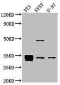 CCND1 Antibody – Figure 1 of 1