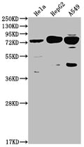 Western Blot
Positive WB detected in: Hela whole cell lysate, HepG2 whole cell lysate, A549 whole cell lysate
All lanes: HTR2C antibody at 1:2000
Secondary
Goat polyclonal to rabbit IgG at 1/50000 dilution
Predicted band size: 52, 29 kDa
Observed band size: 75 kDa