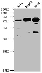 Western Blot
Positive WB detected in: Hela whole cell lysate, HepG2 whole cell lysate, A549 whole cell lysate
All lanes: HTR2C antibody at 1:2000
Secondary
Goat polyclonal to rabbit IgG at 1/50000 dilution
Predicted band size: 52, 29 kDa
Observed band size: 75 kDa