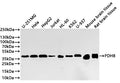 Western Blot
Positive WB detected in: U-251MG whole cell lysate(20µg) ,Hela whole cell lysate(20µg) ,HepG2 whole cell lysate(20µg) ,Jurkat whole cell lysate(20µg) ,HL-60 whole cell lysate(20µg) ,K562 whole cell lysate(20µg) ,U-937 whole cell lysate(20µg) ,Mouse brain tissue lysate(20µg) ,Rat brain tissue lysate(20µg) 
All lanes: PDHB antibody at 1:1000
Secondary
Goat polyclonal to rabbit IgG at 1/40000 dilution
Predicted band size: 39 kDa
Observed band size: 37 kDa
Exposure time：2min