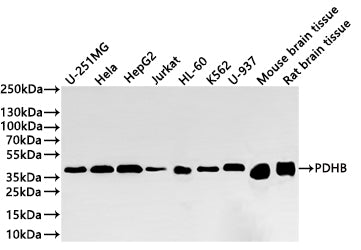 Western Blot
Positive WB detected in: U-251MG whole cell lysate(20µg) ,Hela whole cell lysate(20µg) ,HepG2 whole cell lysate(20µg) ,Jurkat whole cell lysate(20µg) ,HL-60 whole cell lysate(20µg) ,K562 whole cell lysate(20µg) ,U-937 whole cell lysate(20µg) ,Mouse brain tissue lysate(20µg) ,Rat brain tissue lysate(20µg) 
All lanes: PDHB antibody at 1:1000
Secondary
Goat polyclonal to rabbit IgG at 1/40000 dilution
Predicted band size: 39 kDa
Observed band size: 37 kDa
Exposure time：2min