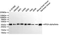 Western Blot
Positive WB detected in: U-251MG whole cell lysate(30µg) , HEK293T whole cell lysate(30µg) , A431 whole cell lysate(30µg) , Jurkat whole cell lysate(30µg) , K562 whole cell lysate(30µg) , Hela whole cell lysate(30µg) , A549 whole cell lysate(30µg) , Mouse brain tissue lysate(30µg) , Rat brain tissue lysate(30µg) 
All lanes: PP2A alpha/beta antibody at 1:1000
Secondary
Goat polyclonal to rabbit IgG at 1/40000 dilution
Predicted band size: 36 kDa
Observed band size: 36 kDa
Exposure time：5s