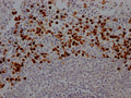 IHC image of CSB-RA617176A0HU diluted at 1:100 and staining in paraffin-embedded human spleen tissue performed on a Leica BondTM system. After dewaxing and hydration, antigen retrieval was mediated by high pressure in a citrate buffer (pH 6.0) . Section was blocked with 10% normal goat serum 30min at RT. Then primary antibody (1% BSA) was incubated at 4℃ overnight. The primary is detected by a Goat anti-rabbit IgG polymer labeled by HRP and visualized using 0.05% DAB.