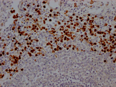 IHC image of CSB-RA617176A0HU diluted at 1:100 and staining in paraffin-embedded human spleen tissue performed on a Leica BondTM system. After dewaxing and hydration, antigen retrieval was mediated by high pressure in a citrate buffer (pH 6.0) . Section was blocked with 10% normal goat serum 30min at RT. Then primary antibody (1% BSA) was incubated at 4℃ overnight. The primary is detected by a Goat anti-rabbit IgG polymer labeled by HRP and visualized using 0.05% DAB.
