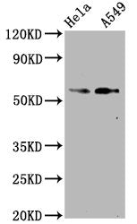 Western Blot
Positive WB detected in Hela whole cell lysate,A549 whole cell lysate
All lanes Phospho-SMAD2 antibody at 1.07μg/ml
Secondary
Goat polyclonal to rabbit IgG at 1/50000 dilution
Predicted band size: 58 KDa
Observed band size: 58 KDa