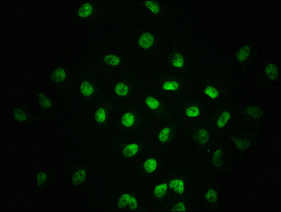 Phospho-SMAD2 (S255) Antibody – Figure 1 of 1
