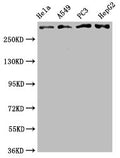 ATM Antibody – Figure 1 of 4