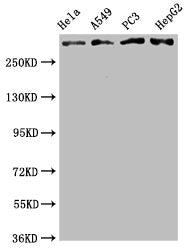 ATM Antibody – Figure 1 of 4