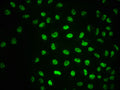 Immunofluorescence staining of Hela cells with CSB-RA618770A1981phHU at 1:100,counter-stained with DAPI. The cells were fixed in 4% formaldehyde, permeabilized using 0.2% Triton X-100 and blocked in 10% normal Goat Serum. The cells were then incubated with the antibody overnight at 4℃. The secondary antibody was Alexa Fluor 488-congugated AffiniPure Goat Anti-Rabbit IgG (H+L) .