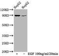 Phospho-RPS6KA1 (T359+S363) Antibody – Figure 1 of 3