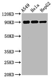 Western Blot
Positive WB detected in A549 whole cell lysate, Hela whole cell lysate, HepG2 whole cell lysate
All lanes Phospho-RPS6KA1 antibody at 1.75μg/ml
Secondary
Goat polyclonal to rabbit IgG at 1/50000 dilution
Predicted band size: 90 KDa
Observed band size: 90 KDa