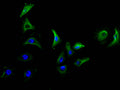 Immunofluorescence staining of A549 cell with CSB-RA619076MA1HU at 1:50, counter-stained with DAPI. The cells were fixed in 4% formaldehyde and blocked in 10% normal Goat Serum. The cells were then incubated with the antibody overnight at 4C. The secondary antibody was FITC-conjugated AffiniPure Goat Anti-Mouse IgG(H+L) .