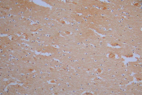IHC image of CSB-RA619084MA1HU diluted at 1:200 and staining in paraffin-embedded human brain tissue performed on a Leica BondTM system. After dewaxing and hydration,  antigen retrieval was mediated by high pressure in a citrate buffer (pH 6.0) . Section was blocked with 10% normal goat serum 30min at RT. Then primary antibody (1% BSA) was incubated at 4°C overnight. The primary is detected by a Goat anti-Mouse IgG labeled by HRP and visualized using 0.05% DAB.