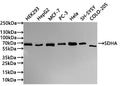 Western Blot
Positive WB detected in: HEK293 whole cell lysate(30µg) , HepG2 whole cell lysate(30µg) ,MCF-7 whole cell lysate(30µg) , PC-3 whole cell lysate(30µg) , Hela whole cell lysate(30µg) , SH-SY5Y whole cell lysate(30µg) , U-251MG whole cell lysate(30µg) 
All lanes: SDHA antibody at 1:1000
Secondary
Goat polyclonal to rabbit IgG at 1/40000 dilution
Predicted band size: 73 kDa
Observed band size: 65 kDa
Exposure time：1min