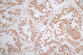 IHC image of CSB-RA620753A0HU diluted at 1:50 and staining in paraffin-embedded human testis tissue performed on a Leica BondTM system. After dewaxing and hydration, antigen retrieval was mediated by high pressure in a citrate buffer (pH 6.0) . Section was blocked with 10% normal goat serum 30min at RT. Then primary antibody (1% BSA) was incubated at 4°C overnight. The primary is detected by a Goat anti-rabbit polymer IgG labeled by HRP and visualized using 0.79% DAB.