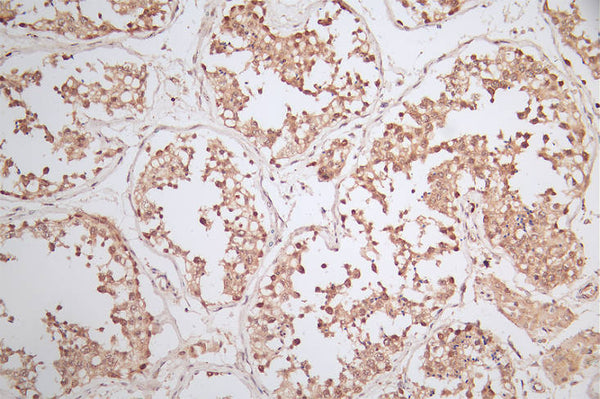 IHC image of CSB-RA620753A0HU diluted at 1:50 and staining in paraffin-embedded human testis tissue performed on a Leica BondTM system. After dewaxing and hydration, antigen retrieval was mediated by high pressure in a citrate buffer (pH 6.0) . Section was blocked with 10% normal goat serum 30min at RT. Then primary antibody (1% BSA) was incubated at 4°C overnight. The primary is detected by a Goat anti-rabbit polymer IgG labeled by HRP and visualized using 0.79% DAB.