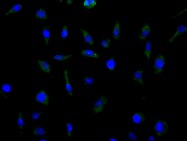 Immunofluorescence staining of MCF cell with CSB-RA620892MA1HU at 1:100, counter-stained with DAPI. The cells were fixed in 4% formaldehyde and blocked in 10% normal Goat Serum. The cells were then incubated with the antibody overnight at 4C. The secondary antibody was FITC-conjugated AffiniPure Goat Anti-Human IgG(H+L) .