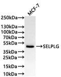 Western Blot
Positive WB detected in: MCF-7 whole cell lysate(30µg)
All lanes: SELPLG antibody at 1:1000
Secondary
Goat polyclonal to human IgG at 1/40000 dilution
Predicted band size: 43 kDa
Observed band size: 43 kDa
Exposure time: 2min