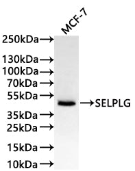 Western Blot
Positive WB detected in: MCF-7 whole cell lysate(30µg)
All lanes: SELPLG antibody at 1:1000
Secondary
Goat polyclonal to human IgG at 1/40000 dilution
Predicted band size: 43 kDa
Observed band size: 43 kDa
Exposure time: 2min
