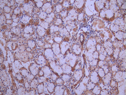 IHC image of CSB-RA621777MA1HU diluted at 1:50 and staining in paraffin-embedded human salivary gland tissue performed on a Leica BondTM system. After dewaxing and hydration, antigen retrieval was mediated by high pressure in a citrate buffer (pH 6.0). Section was blocked with 10% normal goat serum 30min at RT. Then primary antibody (1% BSA) was incubated at 4°C overnight. The primary is detected by a Anti-Human lgG, Fcy Fragment Specific labeled by HRP and visualized using 0.05% DAB.