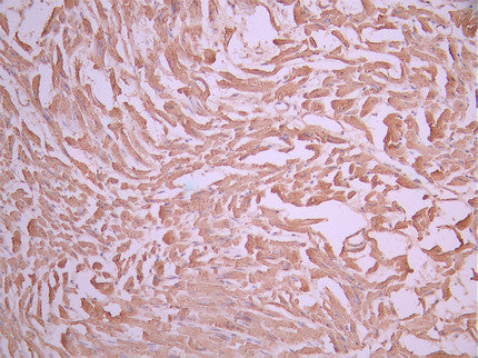 IHC image of CSB-RA623101MA1HU diluted at 1:50 and staining in paraffin-embedded human heart tissue performed on a Leica BondTM system. After dewaxing and hydration, antigen retrieval was mediated by high pressure in a citrate buffer (pH 6.0). Section was blocked with 10% normal goat serum 30min at RT. Then primary antibody (1% BSA) was incubated at 4°C overnight. The primary is detected by a Anti-Human lgG, Fcy Fragment Specific labeled by HRP and visualized using 0.05% DAB.