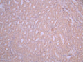 IHC image of CSB-RA624105MA1HU diluted at 1:50 and staining in paraffin-embedded human kidney tissue performed on a Leica BondTM system. After dewaxing and hydration, antigen retrieval was mediated by high pressure in a citrate buffer (pH 6.0). Section was blocked with 10% normal goat serum 30min at RT. Then primary antibody (1% BSA) was incubated at 4°C overnight. The primary is detected by a Anti-Human lgG, Fcy Fragment Specific labeled by HRP and visualized using 0.05% DAB.