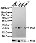Western Blot
Positive WB detected in: Hela whole cell lysate, MCF-7 whole cell lysate, THP-1 whole cell lysate, 293 whole cell lysate, A549 whole cell lysate, K562 whole cell lysate, Colo320 whole cell lysate
All lanes: BAK1 antibody at 0.9μg/ml
Secondary
Goat polyclonal to rabbit IgG at 1/50000 dilution
Predicted band size: 24, 17 KDa
Observed band size: 24 KDa