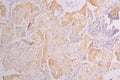 IHC image of CSB-RA624122MA1HU diluted at 1：150 and staining in paraffin-embedded human lung tissue performed on a Leica BondTM system. After dewaxing and hydration, antigen retrieval was mediated by high pressure in a citrate buffer (pH 6.0) . Section was blocked with 10% normal goat serum 30min at RT. Then primary antibody (1% BSA) was incubated at 4°C overnight. The primary is detected by a Goat anti-human polymer IgG labeled by HRP and visualized using 0.05% DAB.