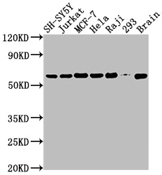Western Blot
Positive WB detected in: SH-SY5Y whole cell lysate, Jurkat whole cell lysate, MCF-7 whole cell lysate, Hela whole cell lysate, Raji whole cell lysate, 293 whole cell lysate, Mouse brain tissue
All lanes: PKM antibody at 1:2000
Secondary
Goat polyclonal to rabbit IgG at 1/50000 dilution
Predicted band size: 58, 59, 57 kDa
Observed band size: 58 kDa