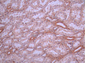 IHC image of CSB-RA632615A0HU diluted at 1:100 and staining in paraffin-embedded human kidney tissue performed on a Leica BondTM system. After dewaxing and hydration, antigen retrieval was mediated by high pressure in a citrate buffer (pH 6.0). Section was blocked with 10% normal goat serum 30min at RT. Then primary antibody (1% BSA) was incubated at 4°C overnight. The primary is detected by a Goat anti-rabbit polymer IgG labeled by HRP and visualized using 0.05% DAB.