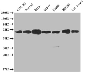 Western Blot
Positive WB detected in: U251 whole cell lysate, Ntera-2 whole cell lysate, Hela whole cell lysate, MCF-7 whole cell lysate, HepG2 whole cell lysate, HEK293 whole cell lysate, Rat heart tissue
All lanes: CBX2 antibody at 1:2000
Secondary
Goat polyclonal to rabbit IgG at 1/50000 dilution
Predicted band size: 57, 24 kDa
Observed band size: 60-72 kDa