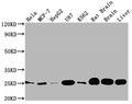 Western Blot
Positive WB detected in: Hela whole cell lysate, MCF-7 whole cell lysate, HepG2 whole cell lysate, U87 whole cell lysate, K562 whole cell lysate, Rat brain tissue, Brain tissue, Liver tissue
All lanes: SOD2 antibody at 1:2000
Secondary
Goat polyclonal to rabbit IgG at 1/50000 dilution
Predicted band size: 25, 21, 19, 20 kDa
Observed band size: 25 kDa